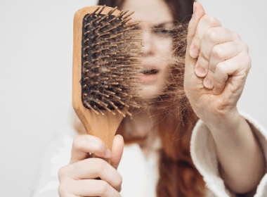 Mách bạn Phương pháp trị rụng tóc giúp kích thích mọc tóc hiệu quả, đơn giản